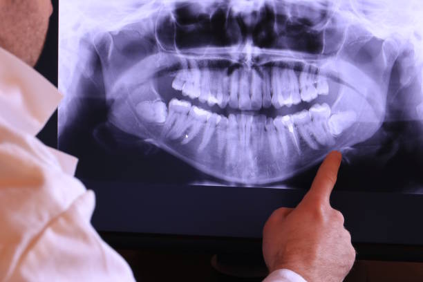 Best Chipped Tooth Repair Near Me  in Dewey Humboldt, AZ
